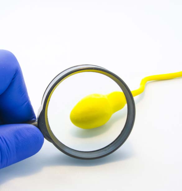 Vasectomy Urologist in Forest Hills, Queens, NY Medex Multi