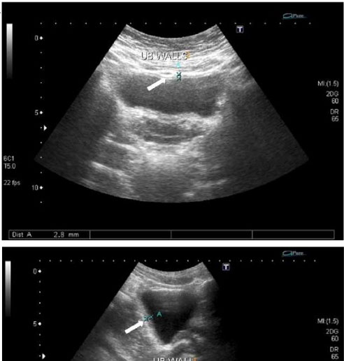 Bladder Ultrasound Urologist In Forest Hills Queens NY Medex bladder-ultrasound-urologist-in-forest-hills-queens-ny-medex
