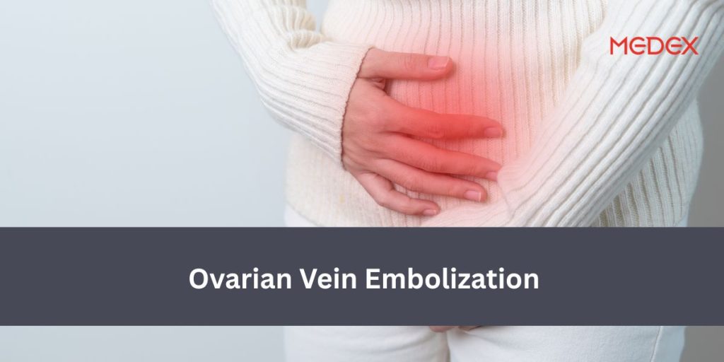 Ovarian Vein Embolization Queens NY